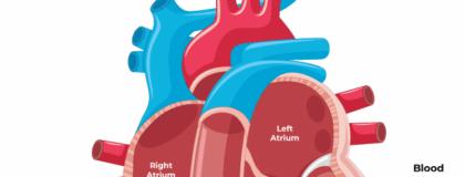 Our Simple Guide to Ventricular Septal Defects (VSD) in Children